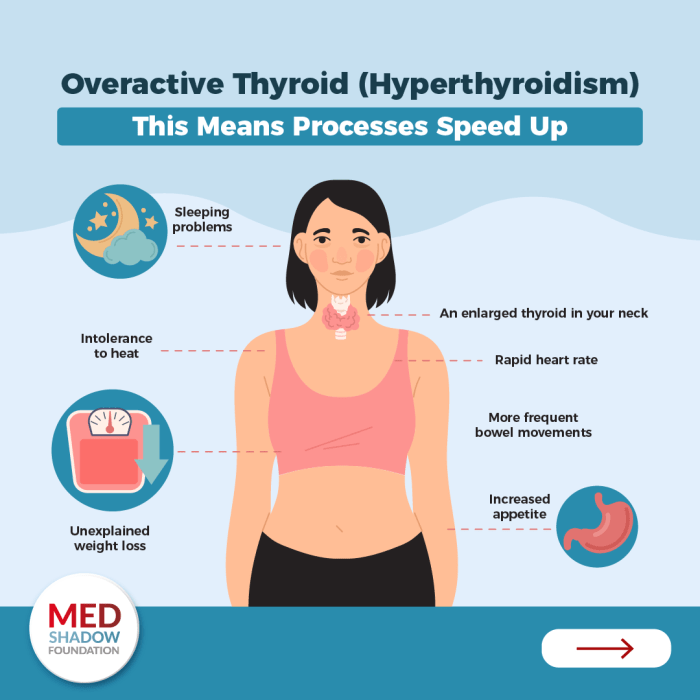 Thyroid infographic imbalance